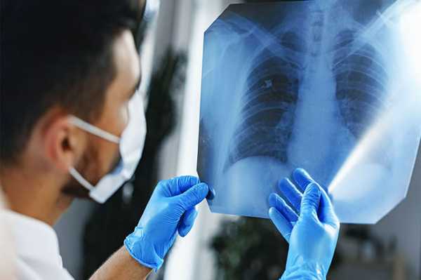 How To Reduce Your Risk Of Developing Lung Cancer